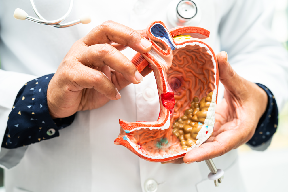 Exercises for Men with Prostate Problems or an Overactive Bladder